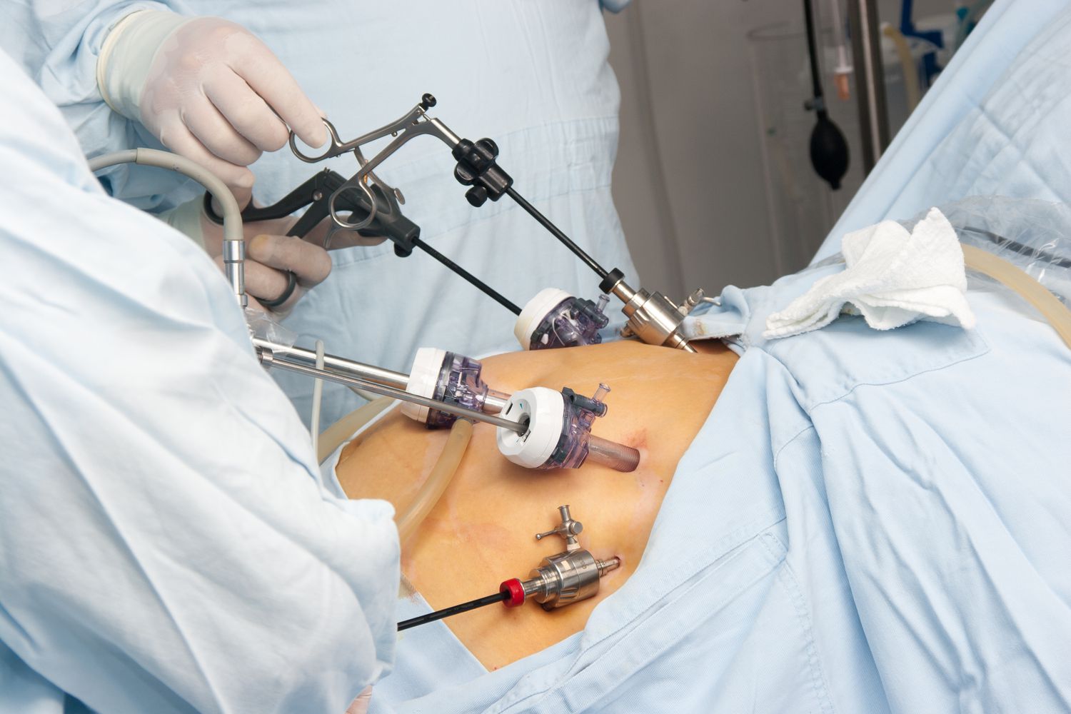 Bariatric Surgery Today: How It’s Saving Lives Beyond Weight Loss