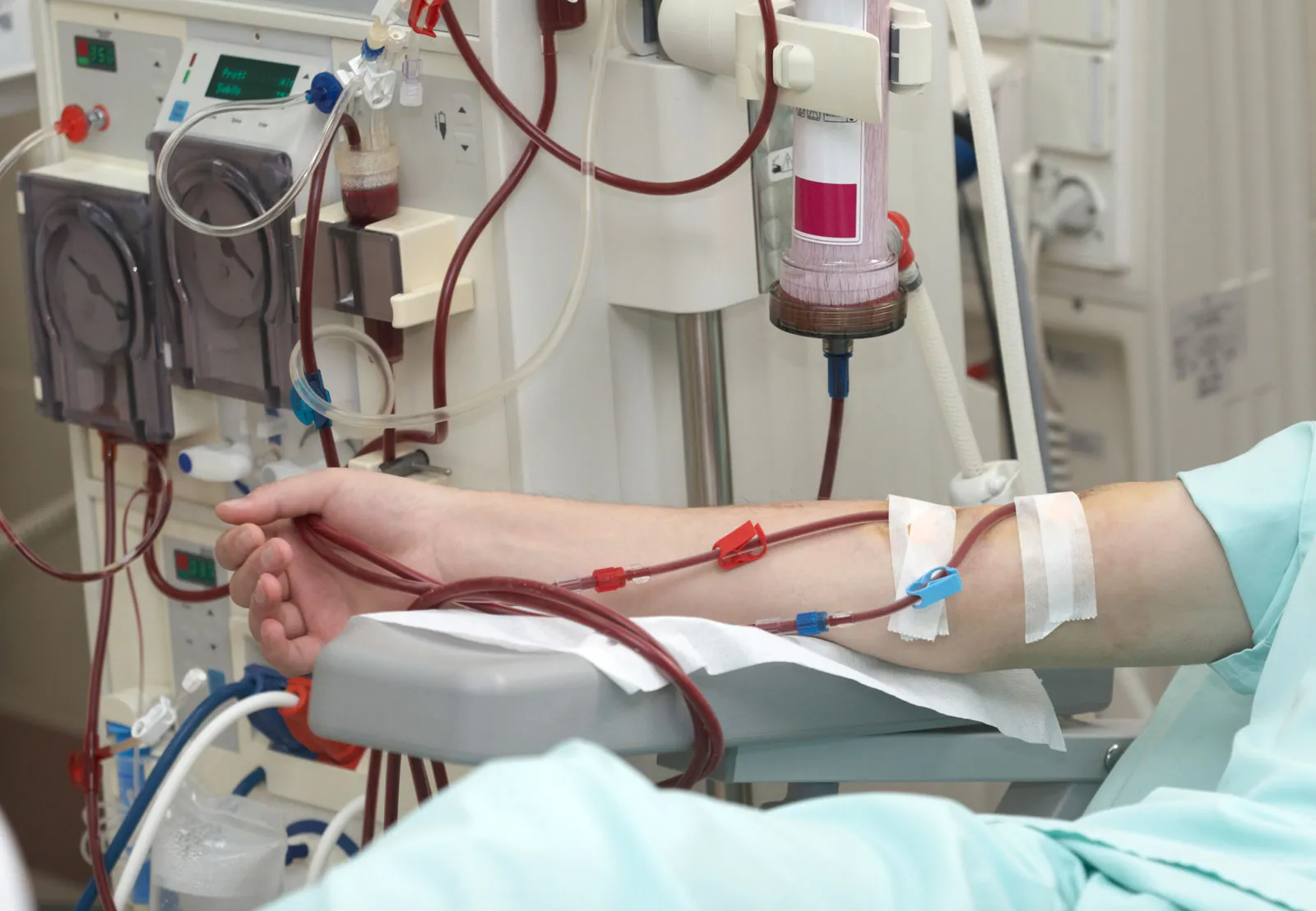 Body Composition Analysis in Dialysis Patient Care