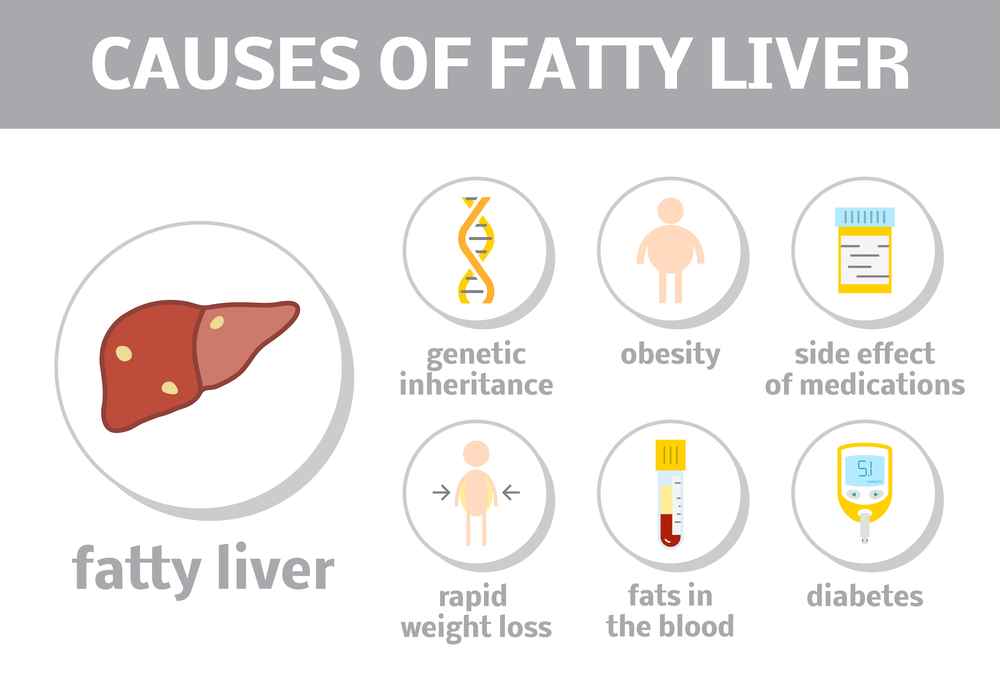 Causes of Fatty Liver