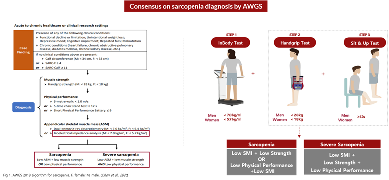 Sarcopenia Diagnosis by AWGS